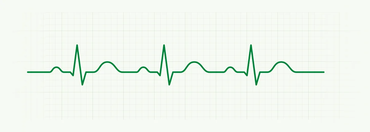 Schematische EKG-Kurve in den grünen Praxisfarben